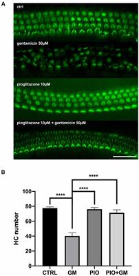 Pioglitazone Ameliorates Gentamicin Ototoxicity by Affecting the TLR and STAT Pathways in the Early Postnatal Organ of Corti